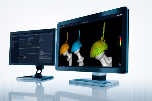 IMA, Implant Movement Analysis
