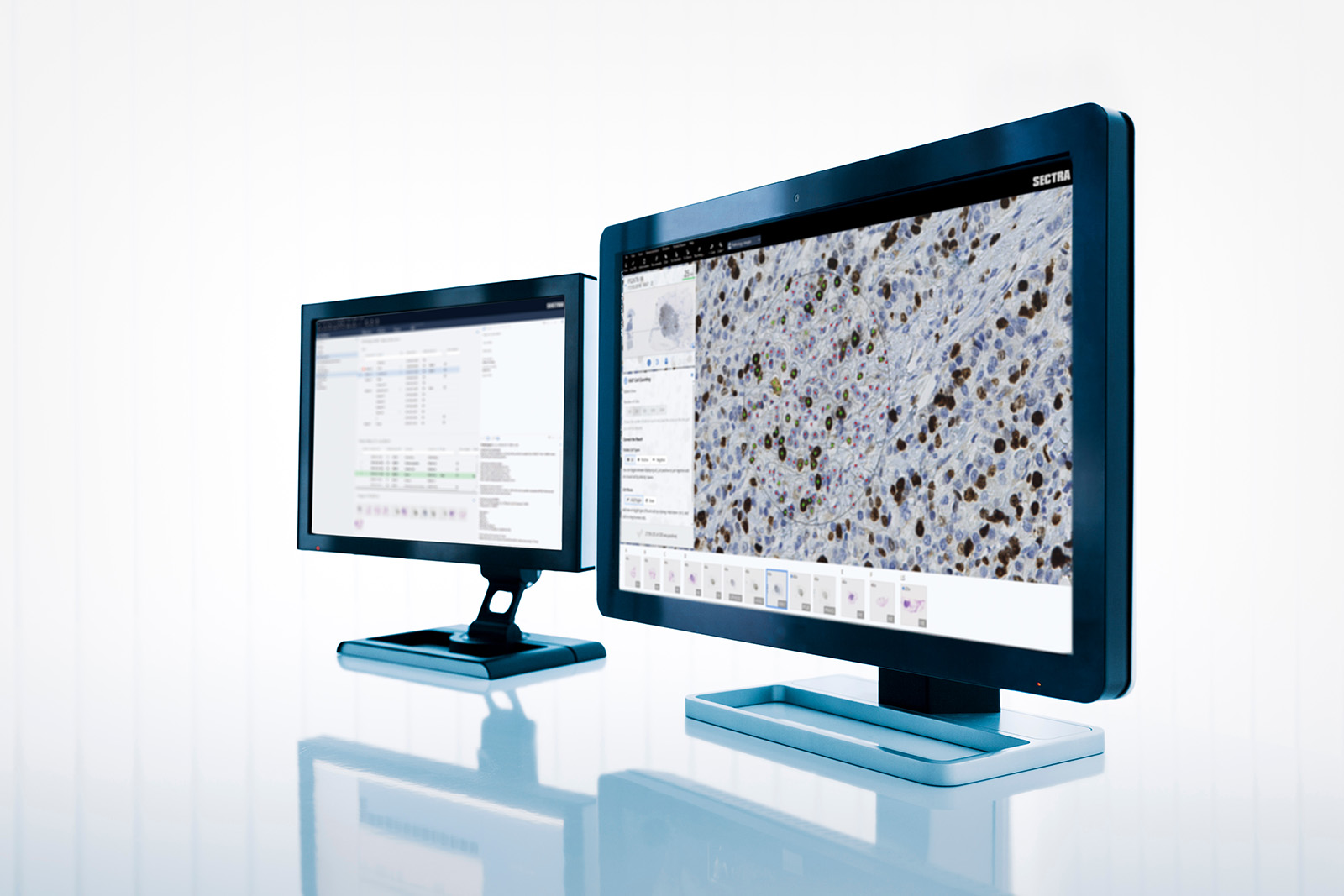 Two monitors with GUI from Sectra's digital pathology solution, one with machine learning application (ki67) running.