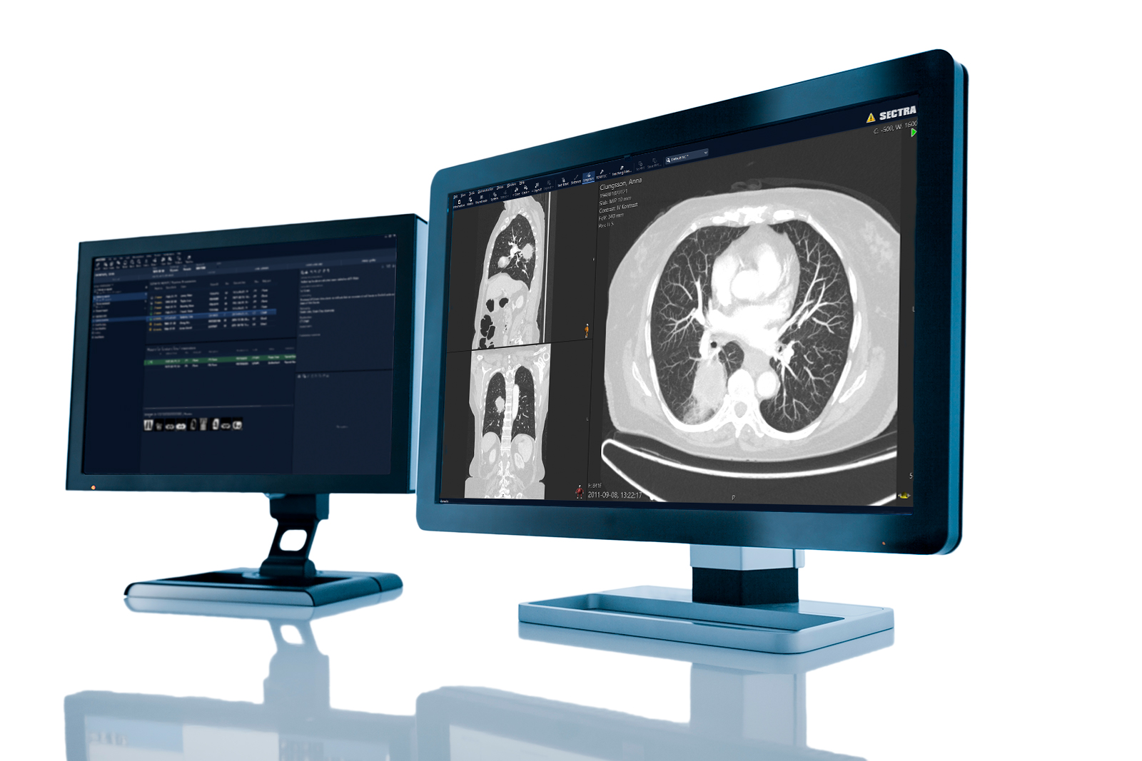 Radiologie-Workstation mit Sectra PACS und Sectra RIS
