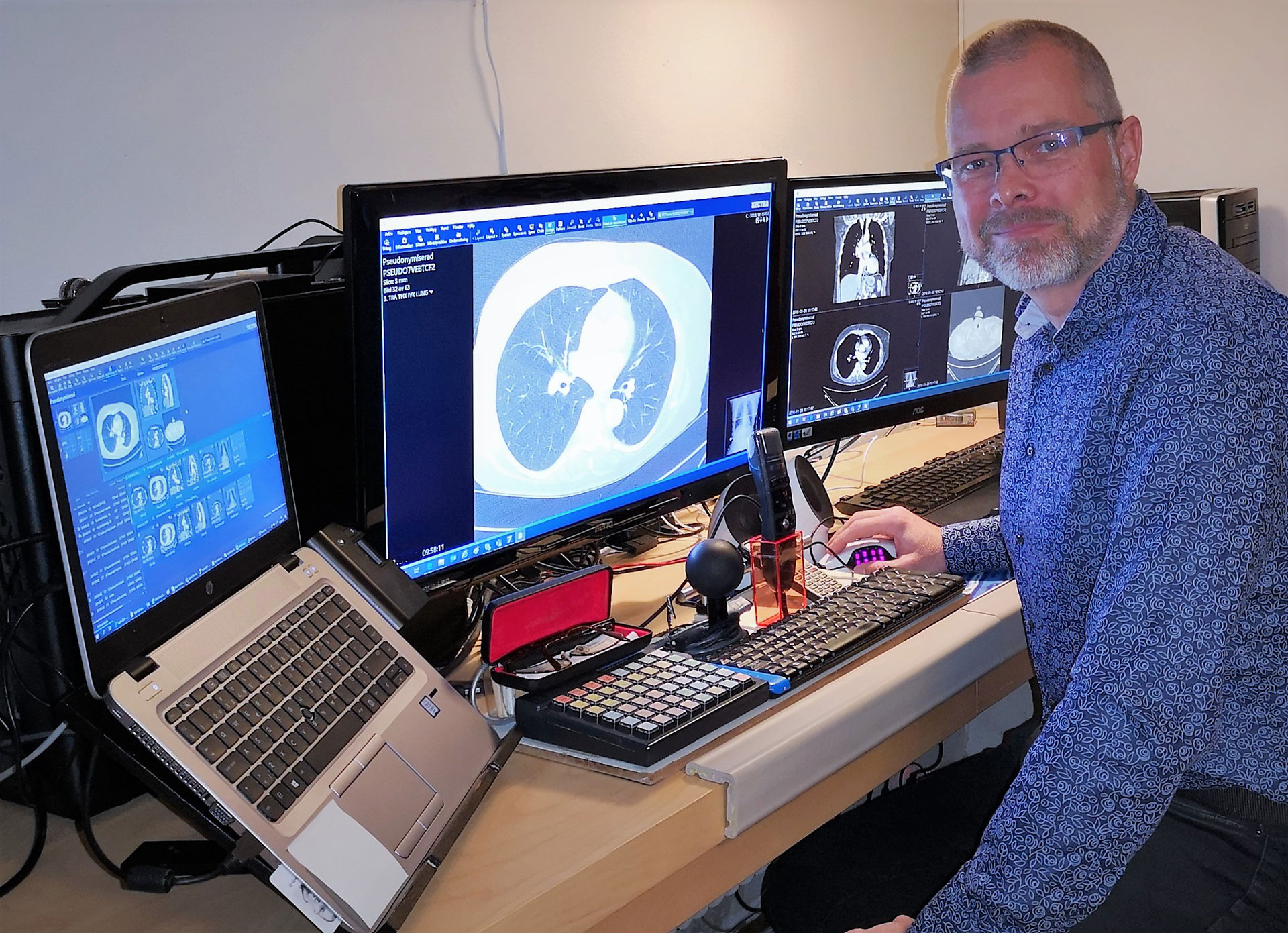 Radiologist Mattias Mjöman by his workstation at home.